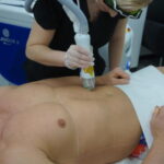 laser-hair-removal-treatment-1