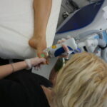 laser-hair-removal-treatment-3