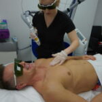 laser-hair-removal-treatment-5