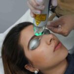 laser-hair-removal-treatment-6